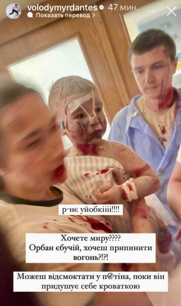 &laquo;Цим потворам байдуже&raquo;: українські зірки відреагували на&nbsp;чергову жахливу ракетну атаку