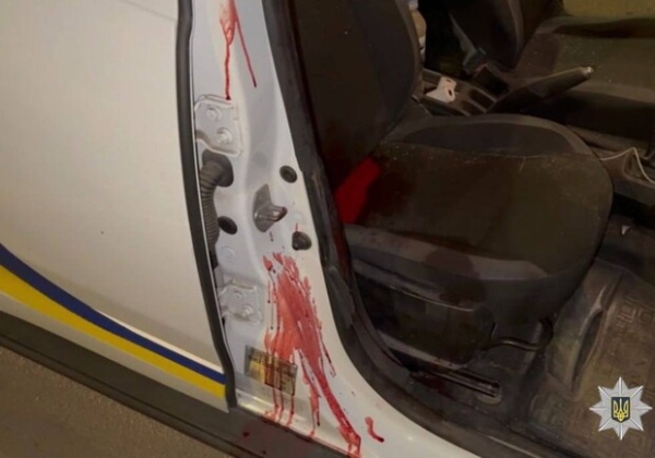 Вооруженное нападение на полицейских в Одессе: в каком состоянии патрульные и видео с бодикамер