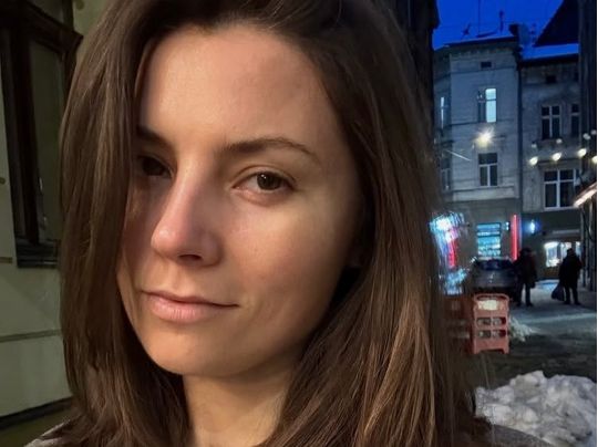 &laquo;Треба знову різати&raquo;: популярна акторка шокувала своїм виглядом (фото)